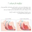 نوزونت بینی وای دی مدل مخروطی