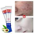 کرم ضد جوش بایو آکوا مدل ACNE ELIMINATION وزن 30 گرم