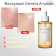 تونر سنتلا مدل Ampoule حجم 100 میلی لیتر