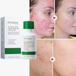 سرم ضد جوش بایو آکوا مدل salicylic acid حجم 35 میلی لیتر