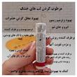 بالم لب فوراور مدل آلوئورا حجم 4.25 میلی‌لیتر با عصاره آلوئه‌ورا، مرطوب‌کننده و ترمیم‌کننده پوست خشک، حساس و ترک‌خورده، مناسب بانوان و آقایان، محافظت از لب و پوست بدن، فاقد رنگ، با ویتامین‌های تقویتی