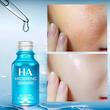 سرم پوست ونزن مدل HYDRATING حجم 100 میلی لیتر