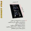 اجاق گاز صفحه ای رینوزیت استار مدل SH2Can