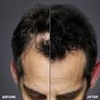 پودر پشت کننده مو تاپیک مدل FIBER وزن 10.3 گرم رنگ قهوه ای تیره به همراه سری پودر پاش