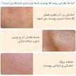 اسکراب لایه بردار پوست بایواکوا مدل  Brightening Exfoliating Rice Gel حجم 140 میلی لیتر