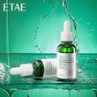 سرم ضد جوش ایتایی مدل Exquisite Essence حجم 30 میلی لیتر