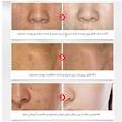 سرم پوست بایو آکوا مدل Rice Raw Pulp Hyaluronic Acid حجم 15 میلی لیتر