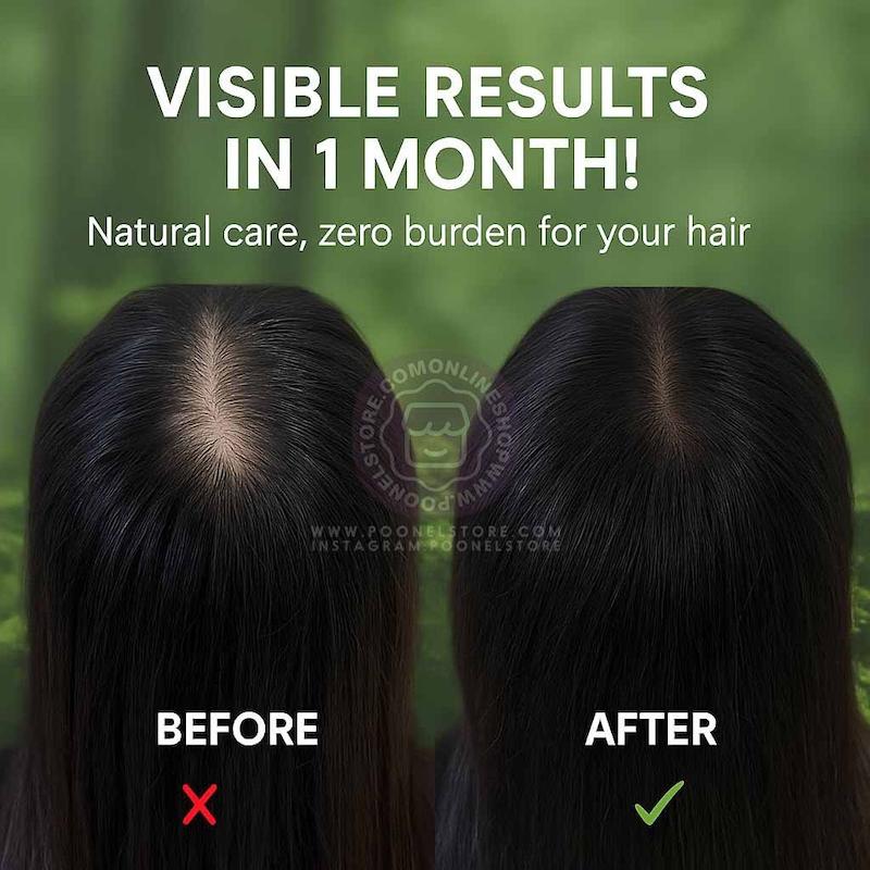 صابون نچرال سون هربال تخصصی رزماری موثر واقعی در رفع ریزش مو و تقویت کننده تاثیرگذار پوست سر حجم 125 گرم Seven Herbal Rosmary Soap OriGinal Version Poonel Store Online ShoppinG Platform