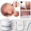چسب بینی لانبنا نسخه اورجینال درمان جوش های بینی و پاکسازی پوست نسخه اورجینال Blackhead Remover LANBENA Black Heads Remover from Face Black Head Remover Peel Off Face Mask Nose Strips for Blackheads