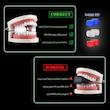 زاویه ساز فک رادیس فیت مدل Full Weight  بسته شش عددی