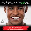 زاویه ساز فک رادیس فیت مدل Full Weight  بسته شش عددی