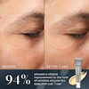 کرم دور چشم رتینال مدیکیت ۶ متوسط Crystal Retinal Ceramide Eye 6