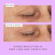 بالم چشم مغذی درانک الفنت Ceramighty™ AF Eye Balm
