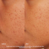 پودر لایه‌بردار روزانه درمالوژیکا ۴۰ گرم  Dermalogica Daily Microfoliant Daily Exfoliant 