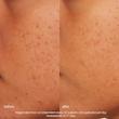 پودر لایه‌بردار روزانه درمالوژیکا ۴۰ گرم  Dermalogica Daily Microfoliant Daily Exfoliant 