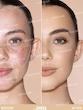کانسیلر پد دار شیگلم مدل Complexion boost