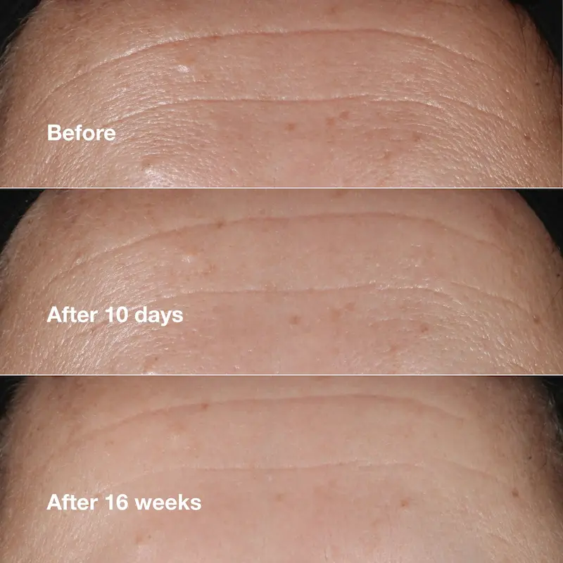 سرم ضدچروک کلینیک Smart Clinical Repair حجم 100 میل