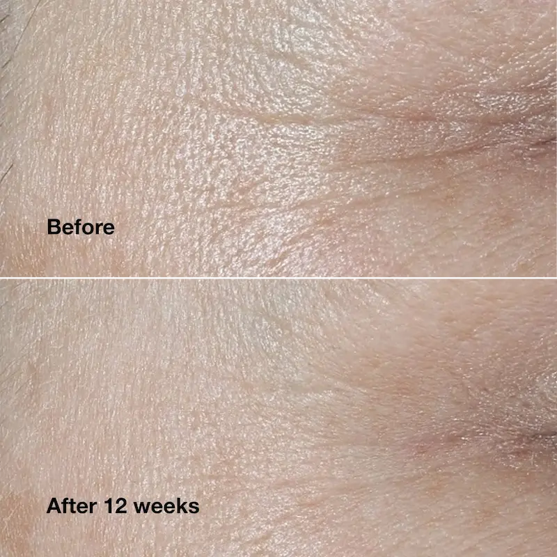 کرم ضدپیری کلینیک Smart Clinical Repair مناسب انواع پوست