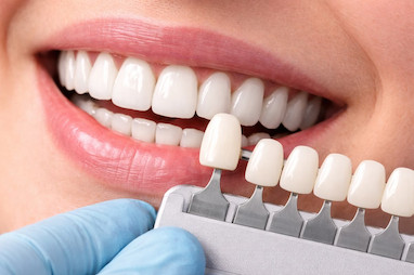 کامپوزیت بهتر است یا لمینیت؟ مقایسه کامل مزایا، معایب، هزینه و دوام