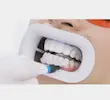دهان‌ بازکن فلش‌ لیپ وایت اسمایل  WHITESMILE Flash Lip Retractor