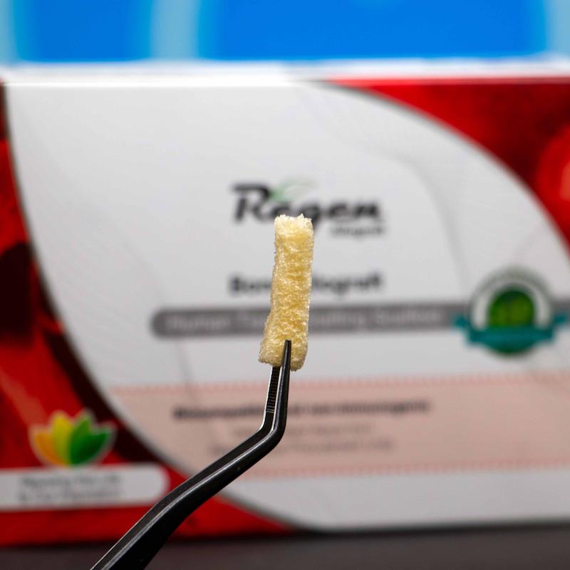 مچ استیک استخوان دمینرالیزه ریجن _ Regen DBM Matchstick