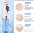 میکرودرم آبریژن اسکوم دار micro bubble