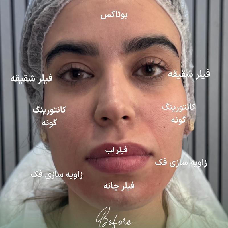 کانتورینگ پکیج نقره ای