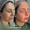 کانتورینگ پکیج طلایی
