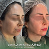 کانتورینگ پکیج طلایی