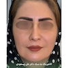 کانتورینگ پکیج الماس
