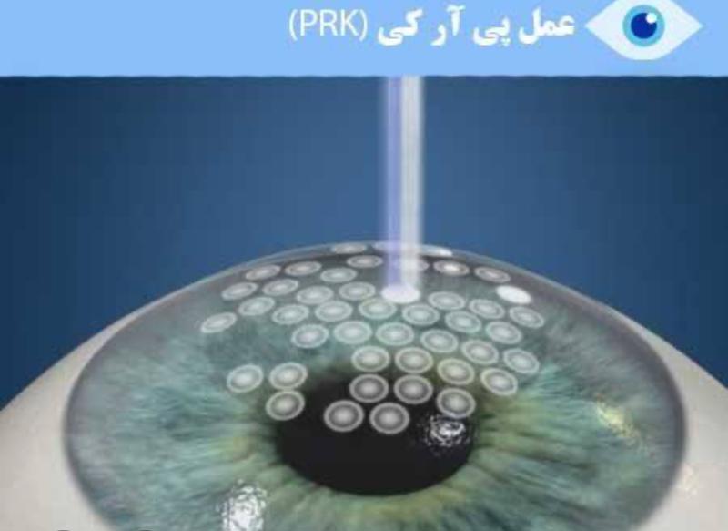 پی ارک پیشرفته 