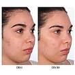    همه کاره رتیول دار یو بیوتی U beauty Resurfacing Compound