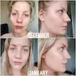 سرم نیاسینامید 10% + زینک 1% اوردینری 30ml اورجينال