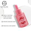 سرم سالسیلیک اسید و روغن درخت چای استلین ESTELIN اورجينال