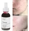 سرم پیلینگ لایه بردار AHA و BHA اوردینری 30ml