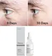 سرم بوتاکس و پرکننده خطوط آرژیرلین 10% اوردینری 30ml 