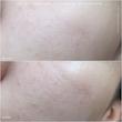 سرم ضدجوش و ضدلک اکسیس وای