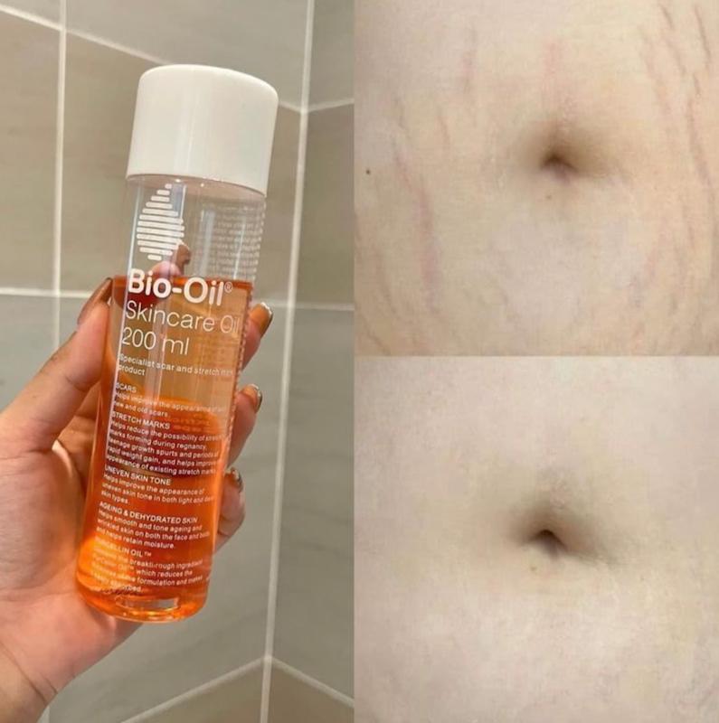 روغن بایو اویل | Bio oil 