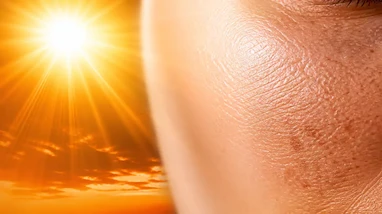اشعه ماوراء بنفش چیست و چه اثراتی بر سلامت پوست میگذارد؟