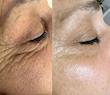 کرم ضد چروک گاتیو ۵ کاره و بوتاکس کننده | Gatieau Anti-Wrinkle Face Cream
