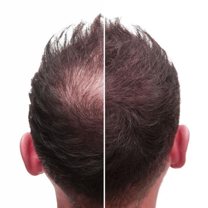 پودر پرپشت کننده مو تاپیک FIBER قهوه‌ای تیره ۵۰ گرم