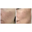 سرم التیام بخش سنتلا ماداگاسکار اسکین 1004 SKIN1004 Madagascar Centella Ampoule