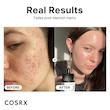 سرم نیاسینامید 15 کوزارکس The niacinamide 15 serum 20ml (Cosrx)