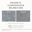 بوستر سرم گلیکولیک اسید آرنسیا لایه بردار ، کنترل منافذ و چربی Arencia Eraser Shot Glycolic Acid Booster