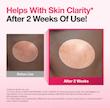 سرم ضد لک نیاسینامید 10% + ترانگزامیک اسید 4% آنوا Anua Niacinamide 10% + TXA 4% Dark Spot Correcting Serum