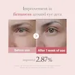 کرم دور چشم PDRN و پپتاید مدی کیوب ضد چروک و روشن کننده Medicube PDRN Pink Peptide Eye Cream