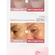 کرم دور چشم PDRN و پپتاید مدی کیوب ضد چروک و روشن کننده Medicube PDRN Pink Peptide Eye Cream