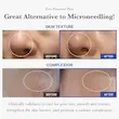 آمپول اگزوزم شات 7500 مدی کیوب لایه بردار و کنترل منافذ Medicube One Day Exosome Shot Pore Ampoule
