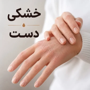 علت خشکی دست
