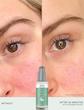 سرم ضد قرمزی رن | Ren Evercalm™ Redness Relief Serum – 15ml